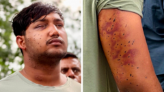 India's 'cockroach' protesters have wounds consistent with pellet-gun fire, say experts