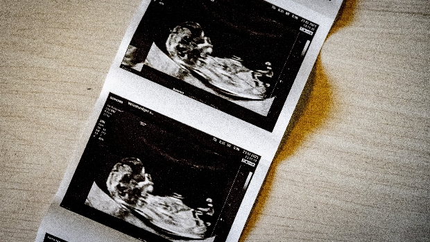 Klachten van vrouw die spijt kreeg van abortus zijn ongegrond. ‘Geen aanwijzing voor verborgen twijfel’