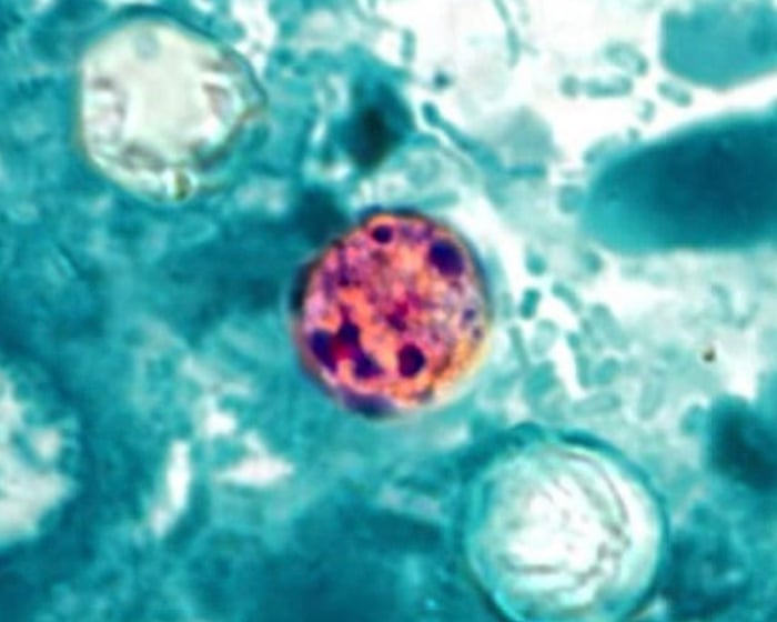 What is cyclosporiasis, the parasitic illness causing ‘explosive’ diarrhea?