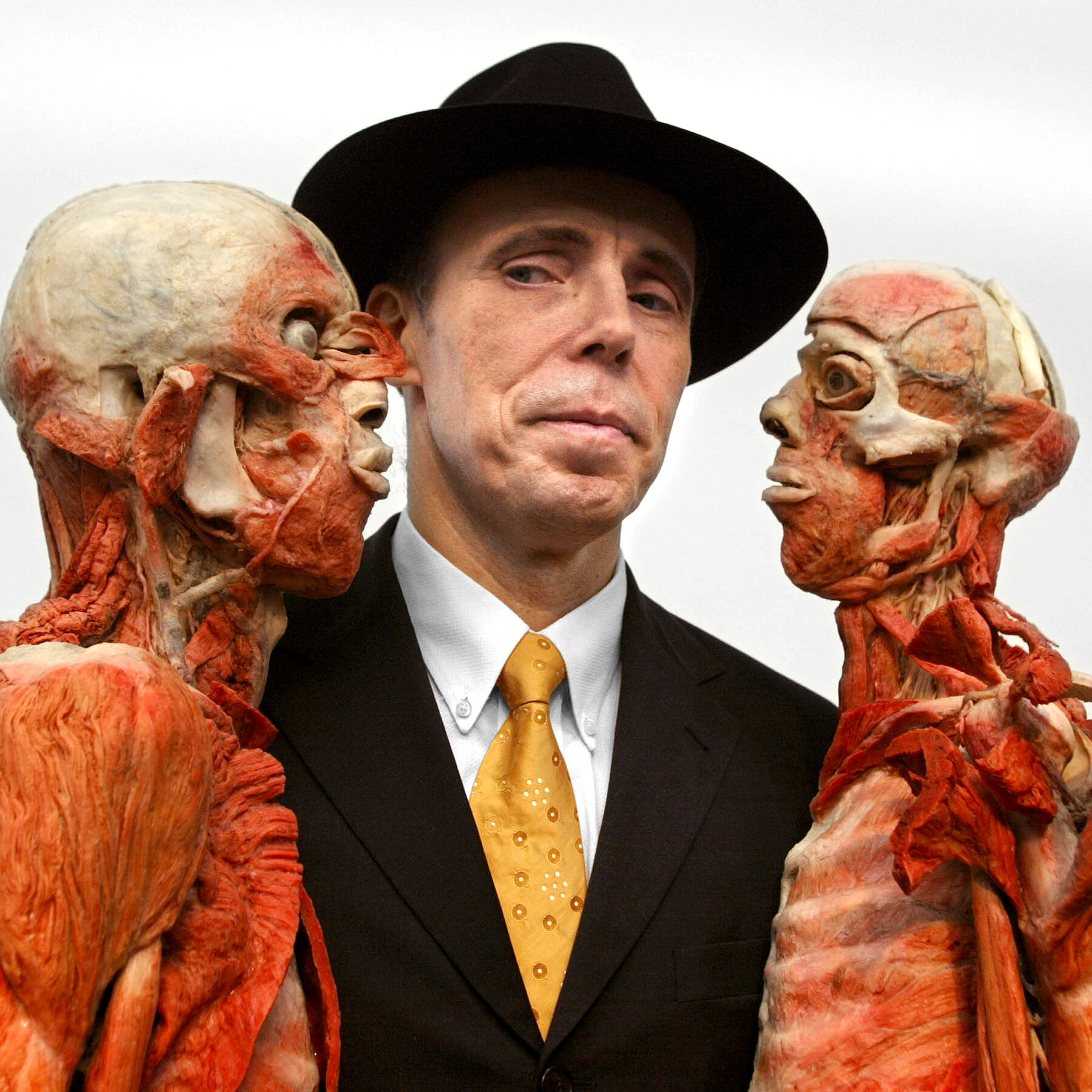 Gunther von Hagens, Creator of Polarizing ‘Body Worlds’ Exhibits, Dies at 81