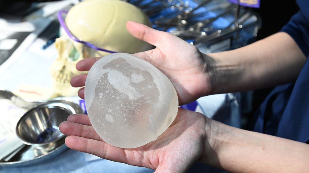 Hoger beroep in zaak van 60.000 vrouwen met mogelijk schadelijke borstimplantaten