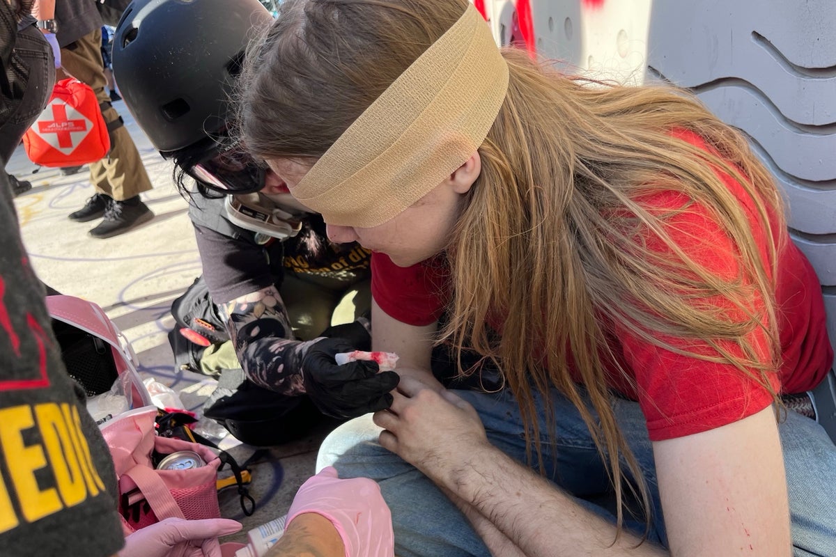 Teen whose eye was surgically removed after DHS shot him files civil rights complaint: ‘I’m in no way an agitator. I just had my camera’