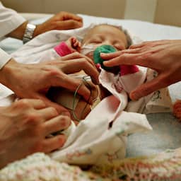 Zeldzame operatie redt baby van ernstige darmaandoening in de baarmoeder