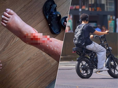 Jolanda (66) werd in haar scootmobiel tot bloedens toe bekogeld met eieren: ‘Ze kiezen een makkelijk slachtoffer’