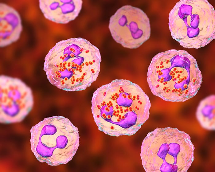 Experts consider expanding meningitis vaccine eligibility after Kent outbreak